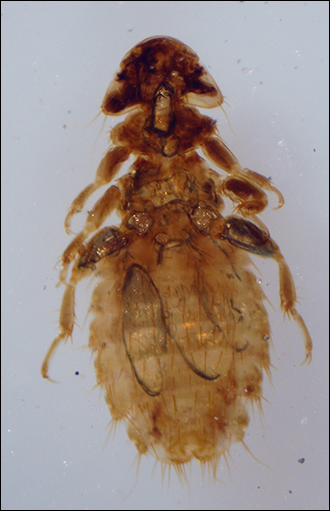 Louse Identification Key